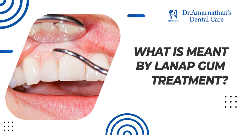 What Is Meant By LANAP Gum Treatment