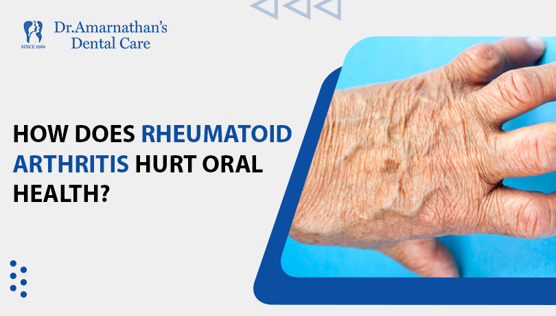 How Does Rheumatoid Arthritis Hurt Oral Health 